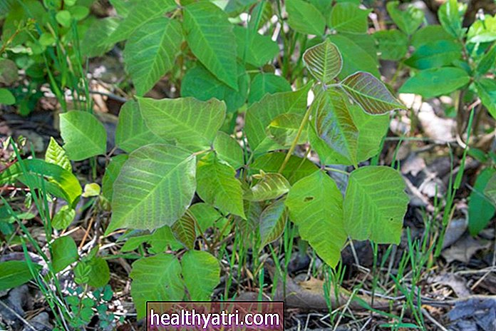 Οι καλύτερες θεραπείες για το Poison Ivy