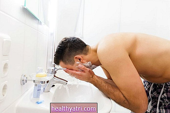 Behandling af acne hos voksne mænd