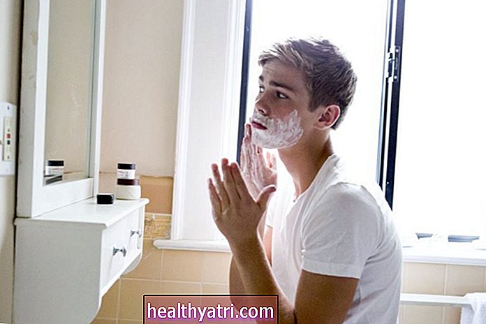 Tratamiento del acné en adolescentes varones