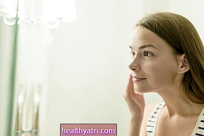 Tratamientos para mujeres con acné en adultos