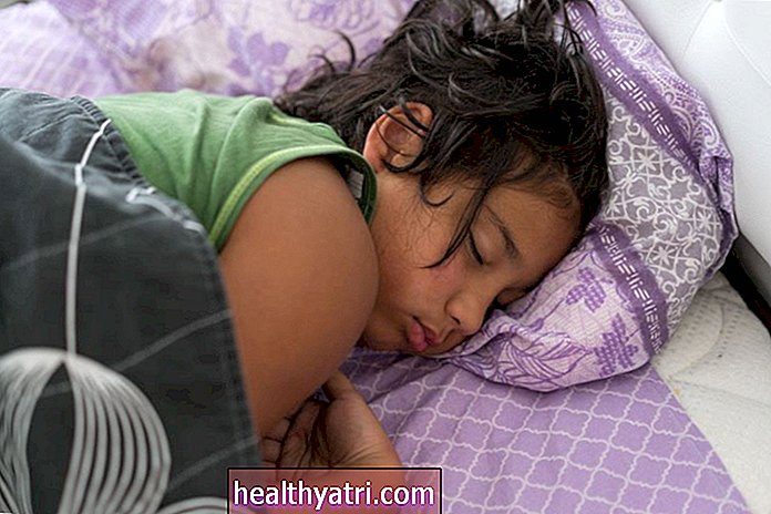Vaikų miego apnėjos priežastys