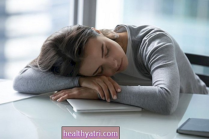 Sobrellevar la narcolepsia