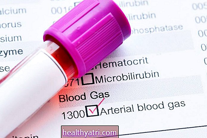 Pruebas y resultados de gasometría arterial (ABG)