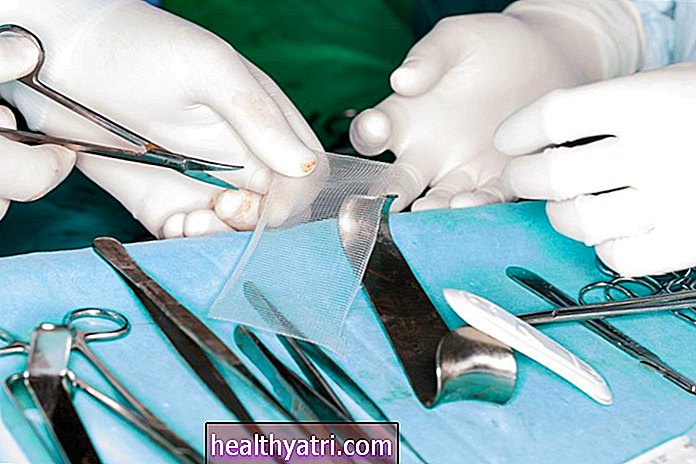 Cirugía de reparación de hernias: descripción general