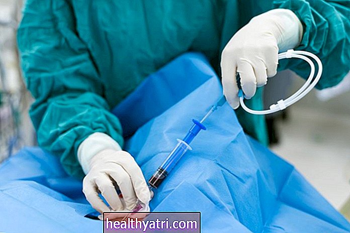 Kas yra endovaskulinė chirurgija?