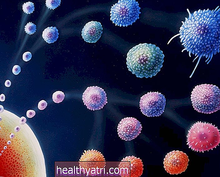 Una panoramica delle malattie autoimmuni
