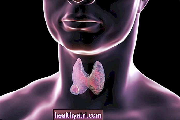 Trăirea cu boala tiroidiană