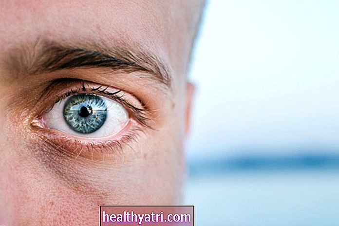 Vairogdziedzera acu slimību progresēšana un prognoze