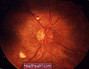 Přehled diabetické retinopatie
