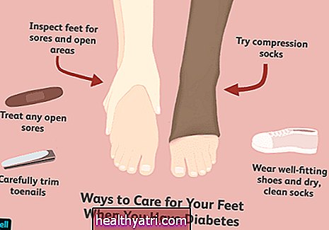 Cuidado del pie diabético