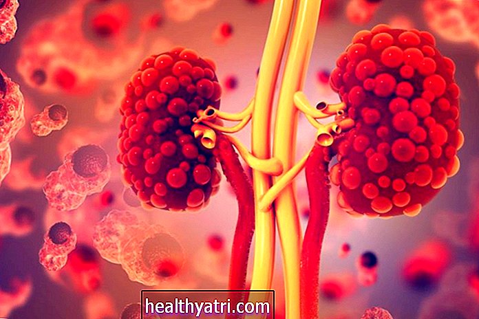 Polycystická choroba ledvin (PKD): Základy