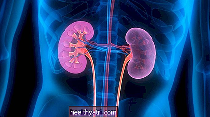 ¿Qué son las anomalías congénitas del riñón y el tracto urinario (CAKUT)?