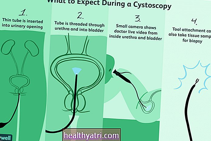 Kas yra cistoskopija?